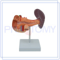 PNT-0470 Pancreas Duodenum et Spleen model